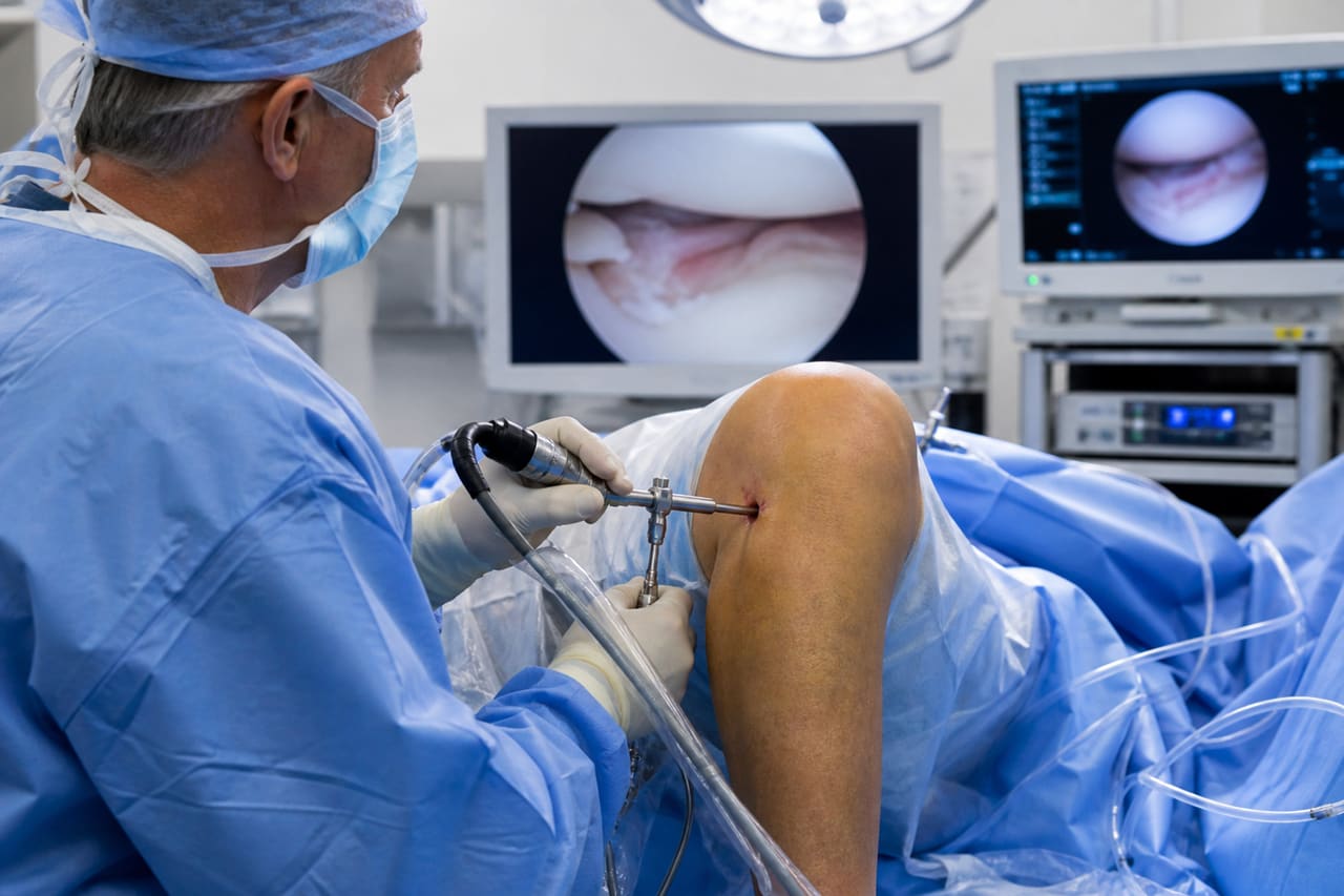 Orthopedic Surgeon Using Arthroscope for Meniscus Tear Examination