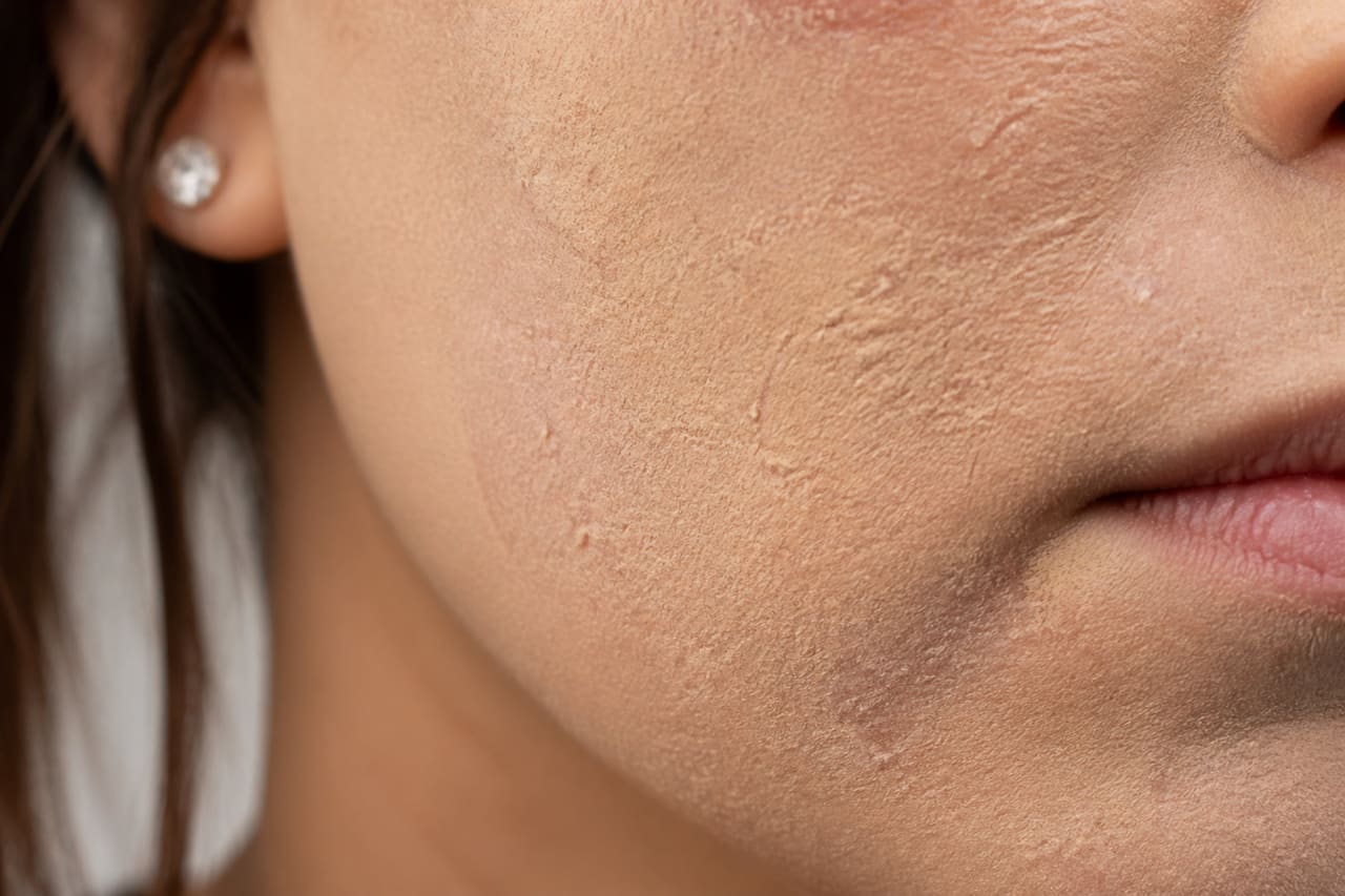Close Up of Cakey Foundation on Dry Skin